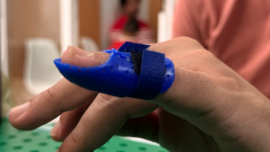 Órtesis de dedo azul con velcro fabricada a la medida en RehabiliTO