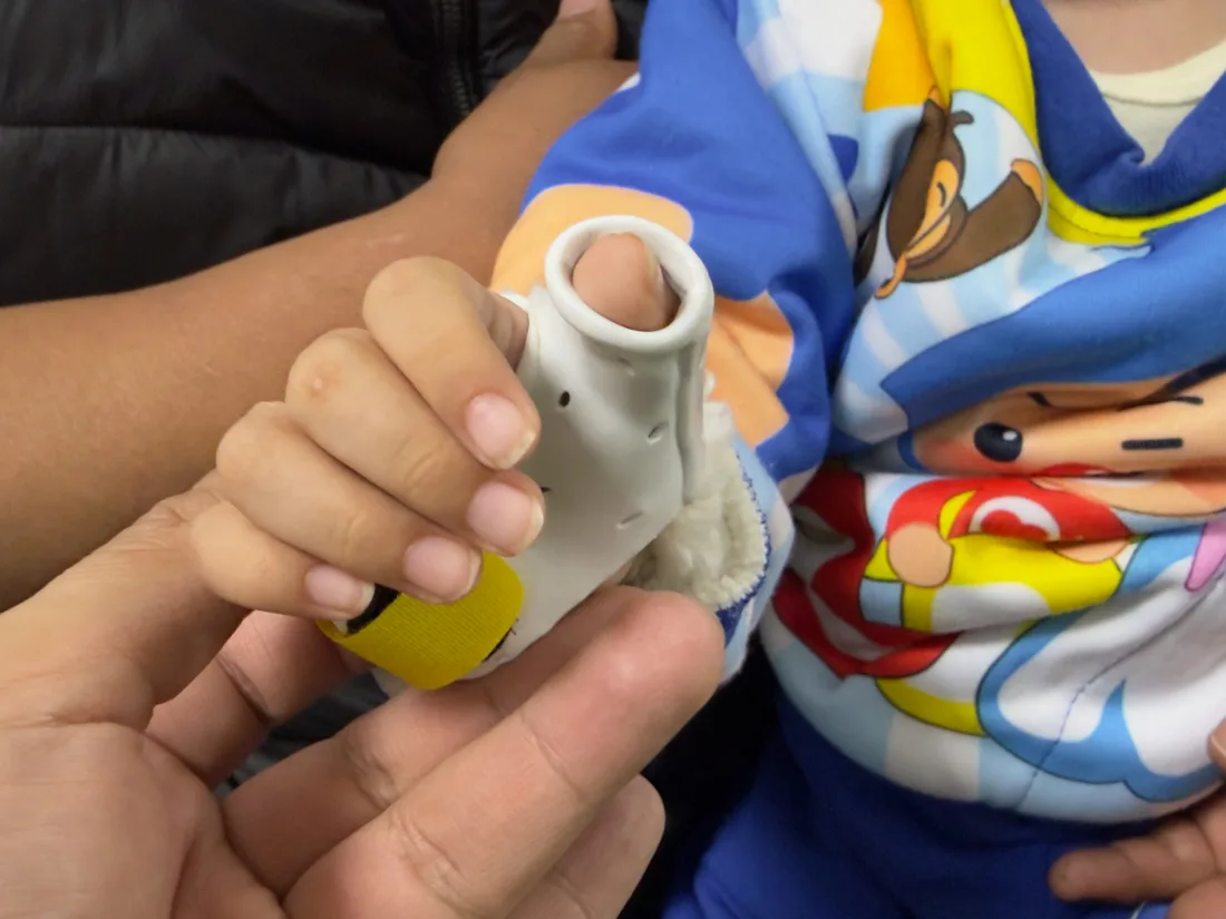 Órtesis pediátrica de mano fabricada a la medida en RehabiliTO